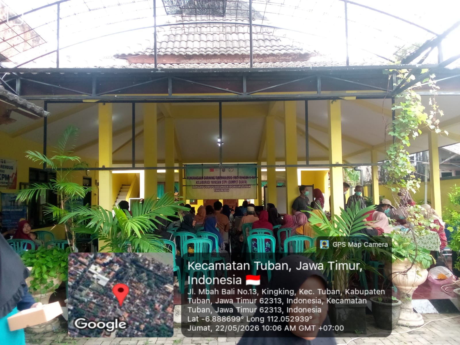 PEMERIKSAAN SKRINING TUBERULOSIS [TBC]DENGAN XRAY BERKOLABORASI DENGAN YAYASAN STPI (DOMPET DUAFA) DENGAN UOBF PUSKESMAS KEBONSARI TUBAN 